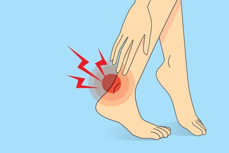 Three Common Ankle Injuries